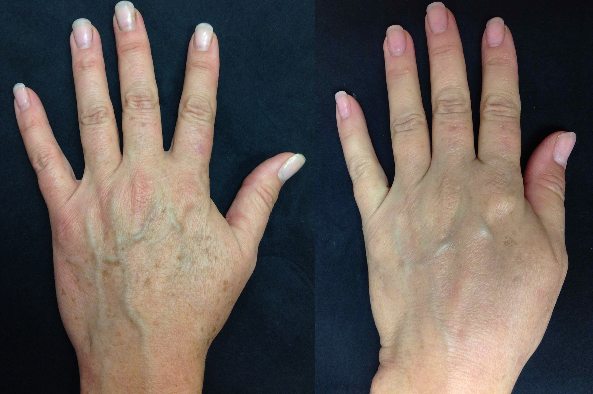Before and after close-up on hands